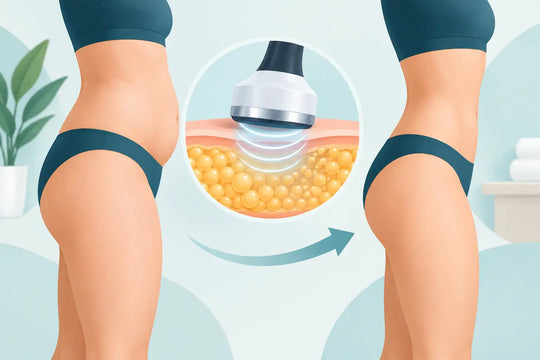 What Cavitation Client Outcomes Look Like