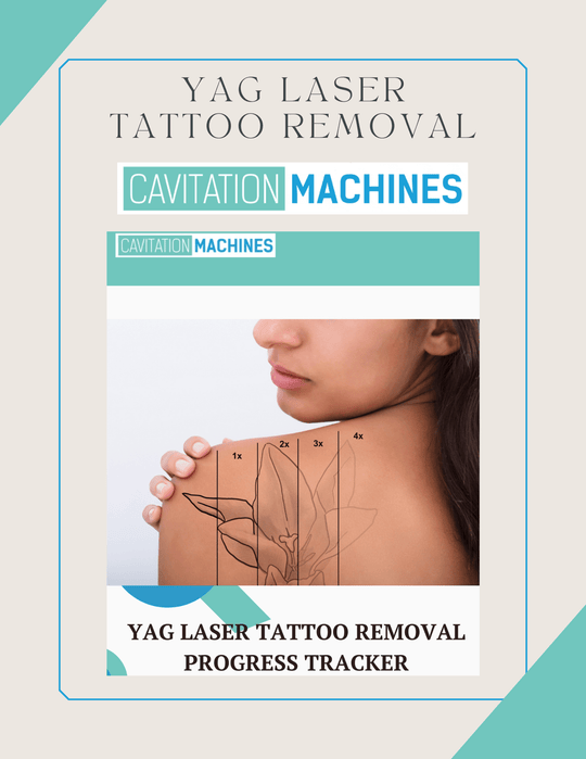 YAG Laser Tattoo Removal Progress Tracker - Cavitation Machines