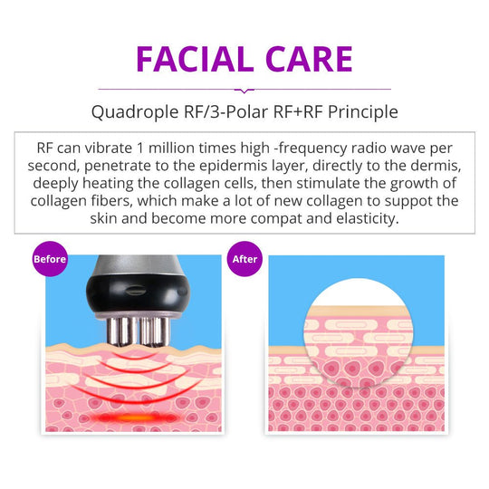 Shape Tactics Portable 5-in-1 Cavitation RF Vacuum Contouring System